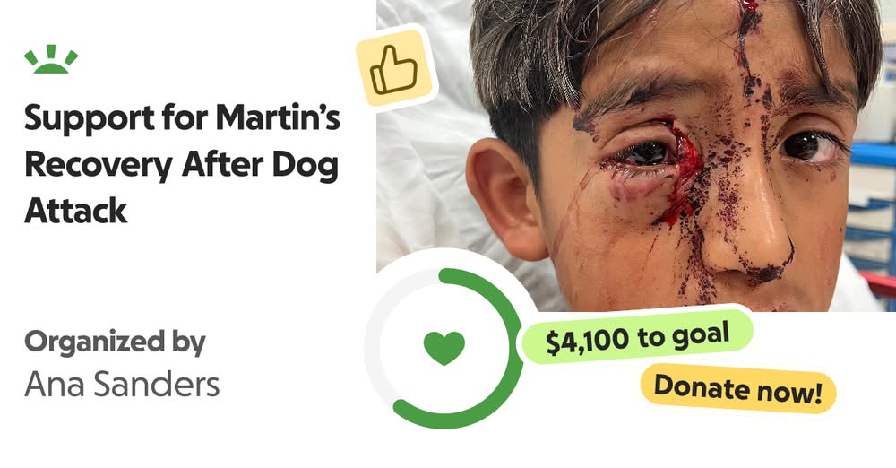 Community Responds: Gadsden ISD and City of Sunland Park Weigh In on Recent “Severe Dog Attack”